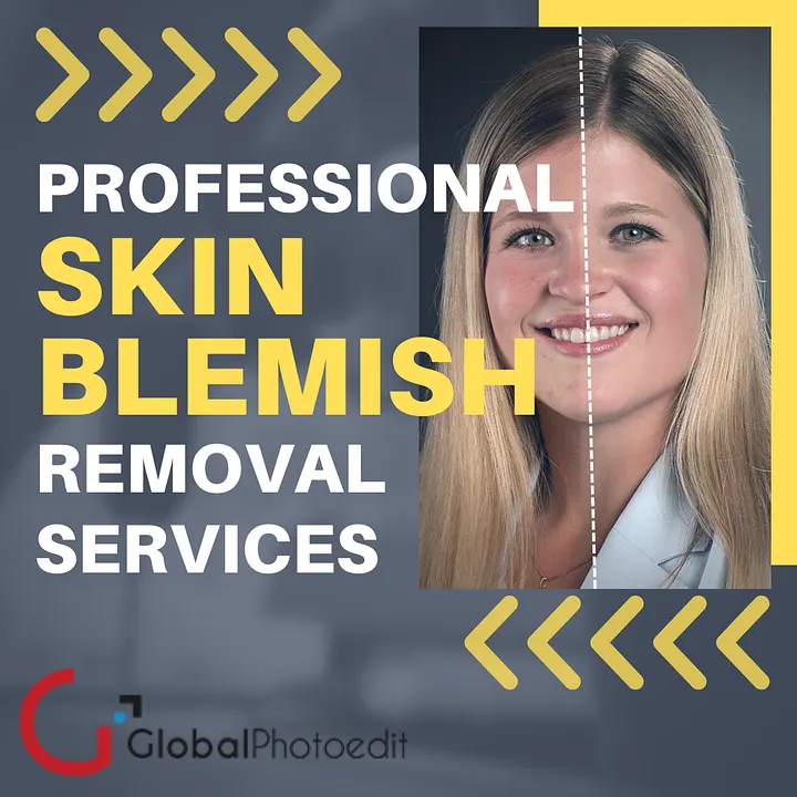 Online Skin Blemish Removal Services