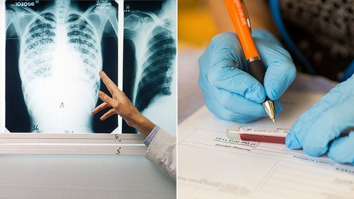 Finding A TB Test Near Me Your Guide To Tuberculosis Testing By 2step-ppd-tb-form-ppd-form-state-of-california-screening-of
