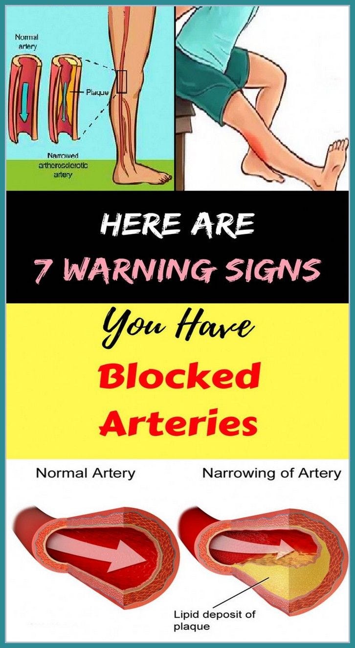 Here Are 7 Warning Signs You Have Blocked Arteries Laura Medium