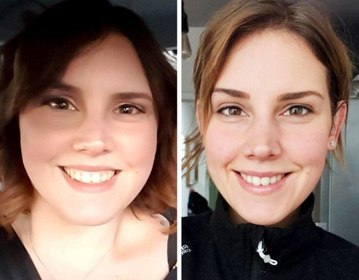how weight loss changes your face? by Weightlossingenuity Medium