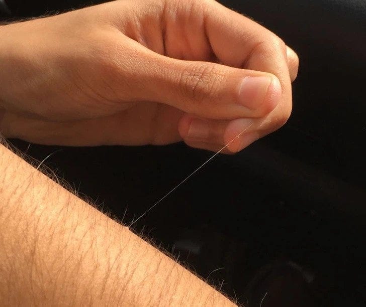 Leaping Hair: The Extremely Long Single White Hair That Grows Overnight ...