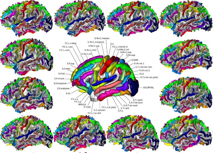 Brain карта