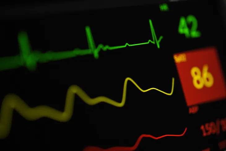 EKG monitoring heart activity