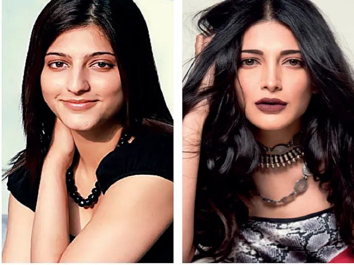 South Indian Celebrities Embracing Aesthetic Transformations: Redefining Beauty with Plastic…