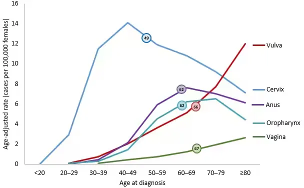 Graph depicting the occurrence of different types of HPV related cancers and at what ages they are diagnosed on average