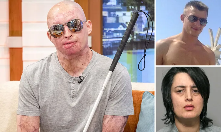 Man Left Blind, Disfigured After Girlfriend Attacks Him With Acid