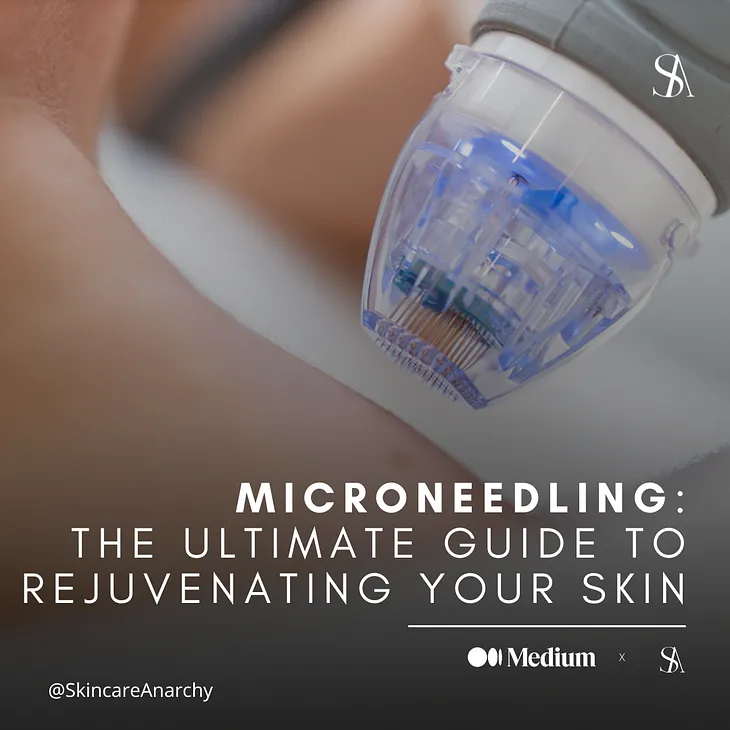 Microneedling: The Ultimate Guide to Rejuvenating Your Skin