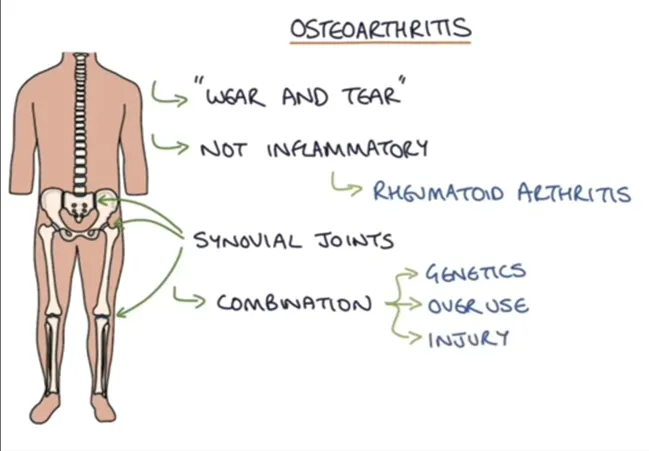 RHEUMATISM OR ARTHRITIS? AGE OR GENES? (Ch.1)