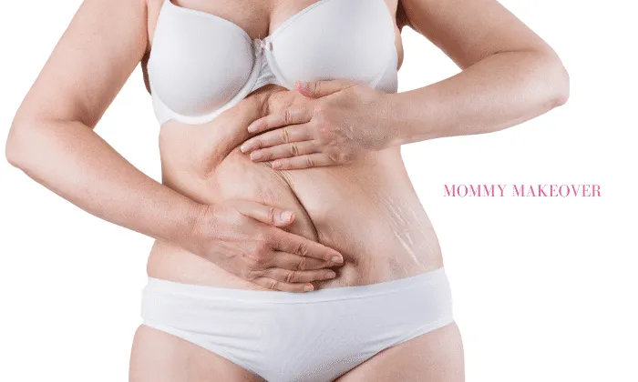 Can Mommy Makeover Give Me a New Body?