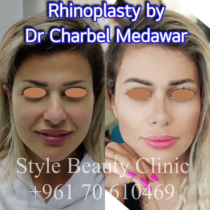 Aging with Grace: Dr Charbel Medawar AdressesYour Rhinoplasty Concerns as You Mature