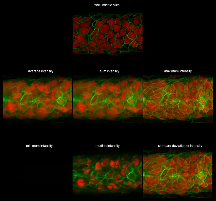 An Intoduction To Biological Image Processing in ImageJ, Part 3: Stacks and Stack Projections