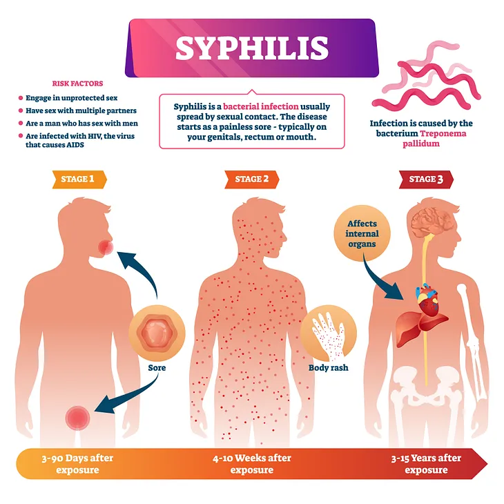 V.D.R.L ( SYPHILIS )