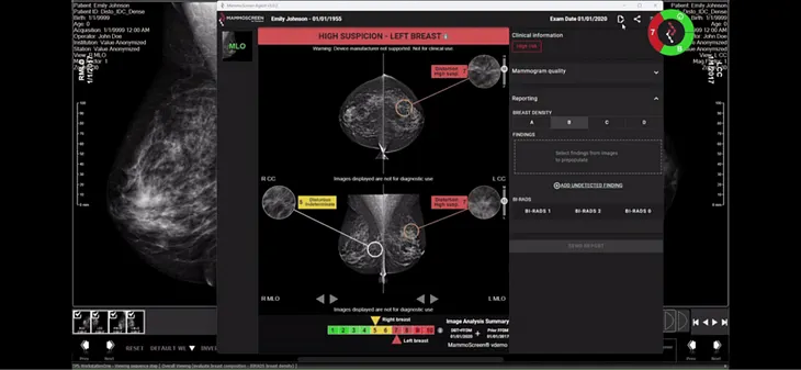 How AI is Transforming Medical Imaging Equipments Into Smart Diagnostic Tools