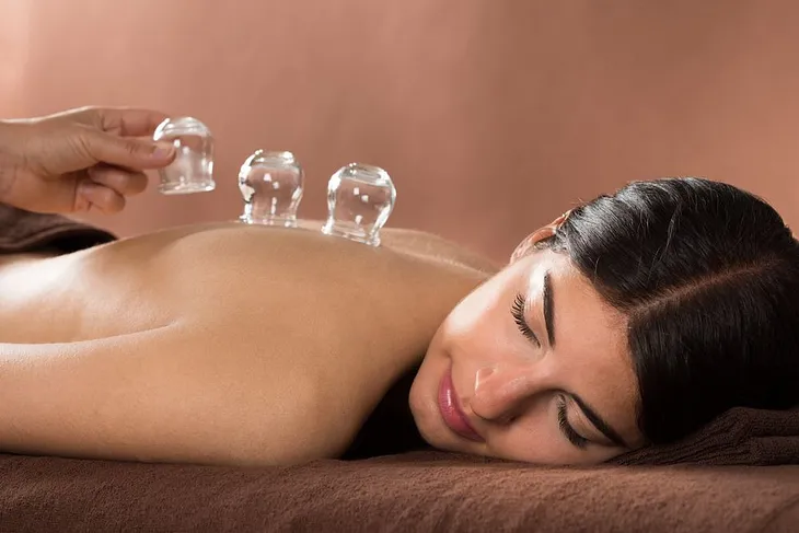 Why You Should Go For a Cupping Therapy Once in Lifetime?