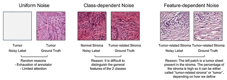 Label Noise and Its Problems for Computer Vision Model in Histopathology