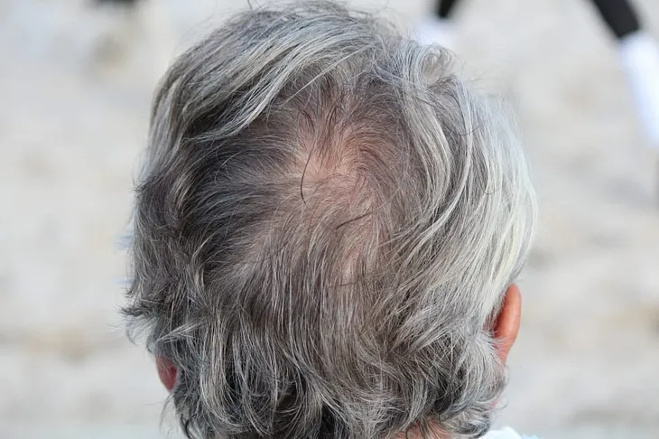 Can white hair turn black again? 7 Natural home remedies for white hair