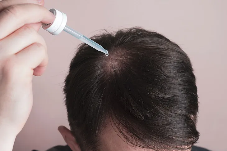 Minoxidil is the most famous drug used for the treatment of hair fall.