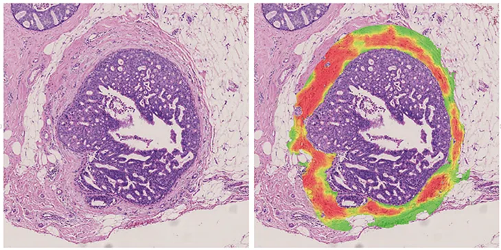 AI in Computational Pathology