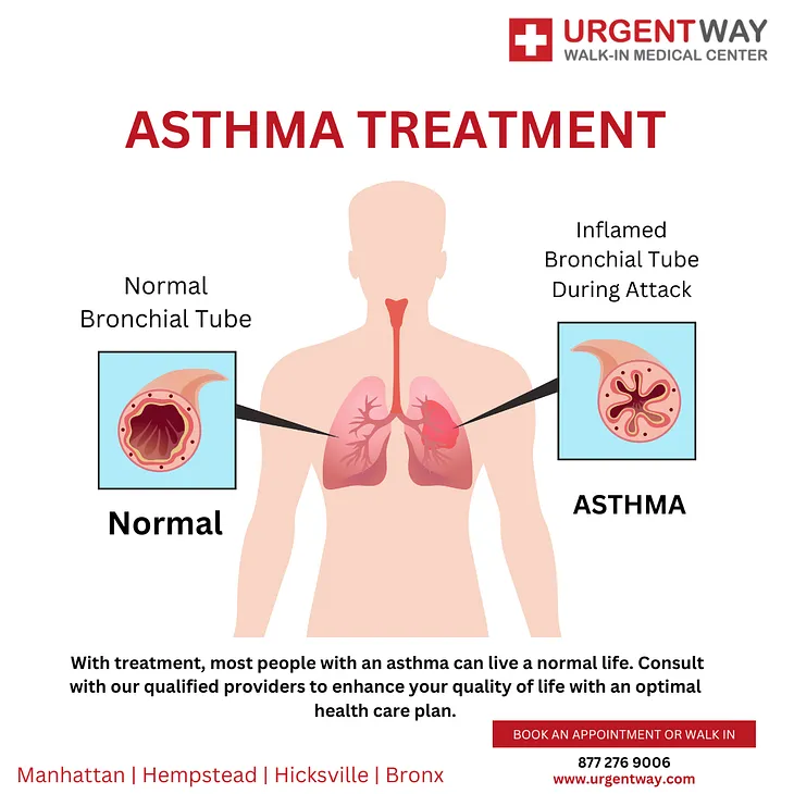 Asthma Symptoms & Diagnosis