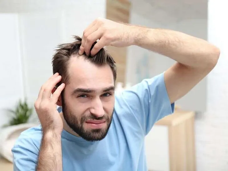 7 Oral Minoxidil for Hair Loss Facts You Should Know