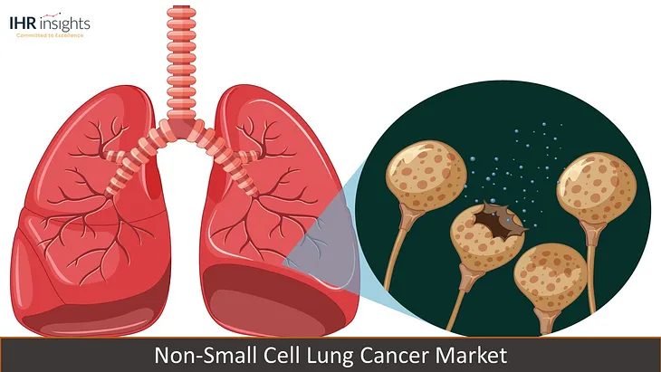 The Impact of Pollution on Non-Small Cell Lung Cancer: Unveiling the Connection — A Blog by IHR…