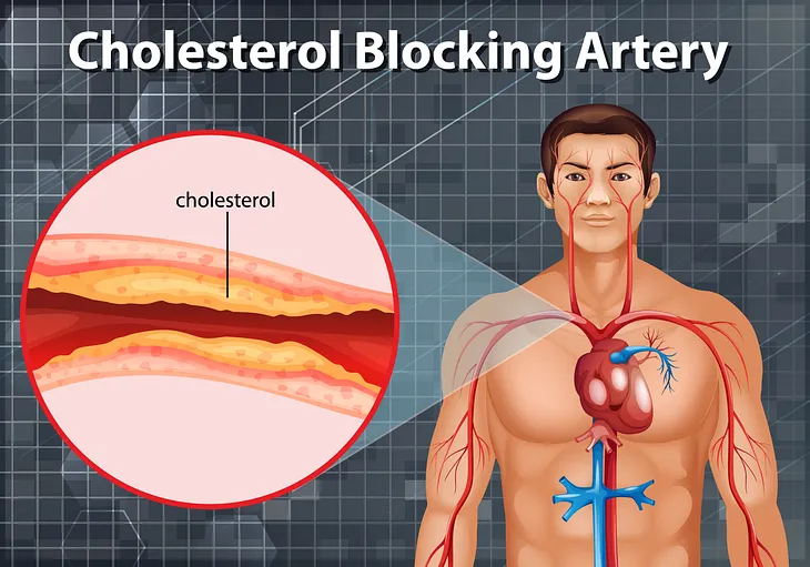 Something Special About Cholesterol –You Should Never Avoid For Yourself