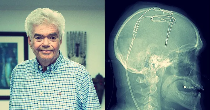 The Scientist Who Got a Brain Implant to Cure His Alcoholism