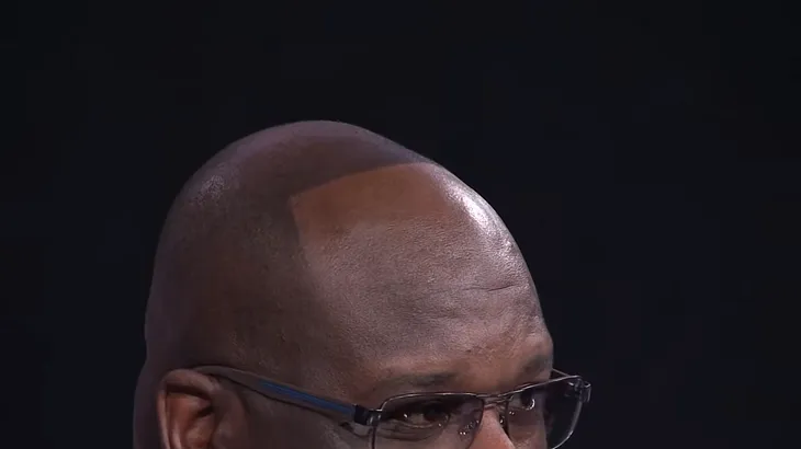 Receding Hairline