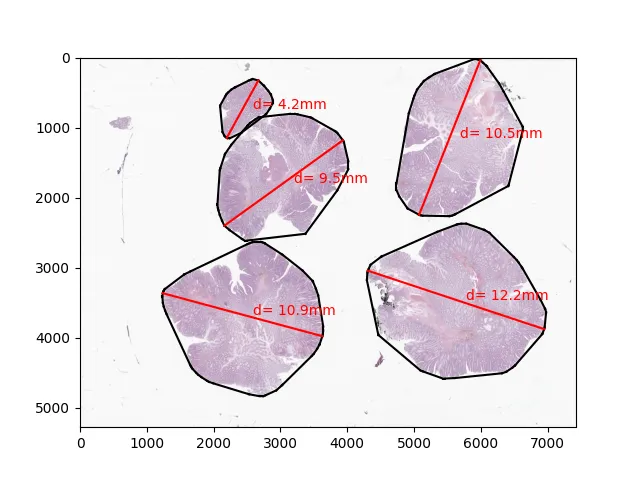 Tissue sample extents plotted in MatPlotLib