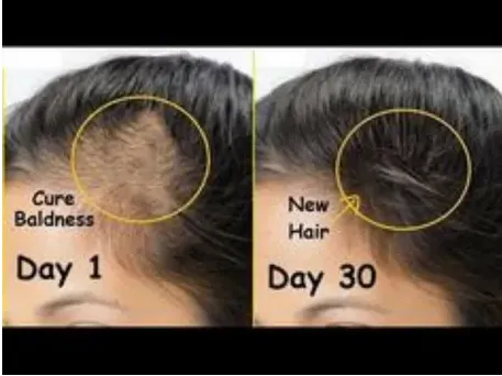 Doctor Develops Insane Remedy For Hair Loss