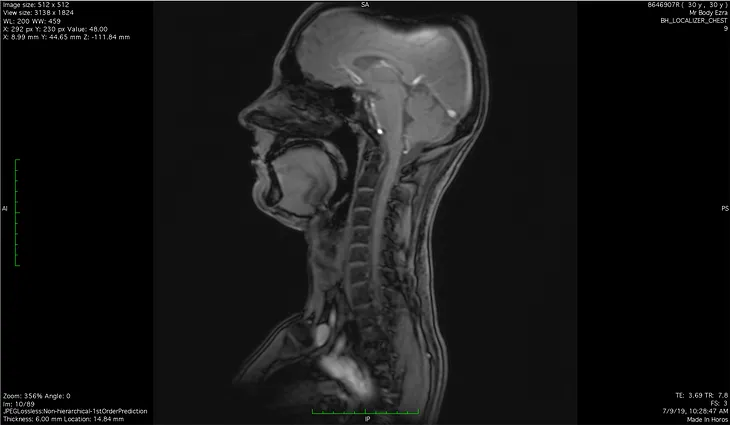 I Tried the Ezra Full-Body MRI