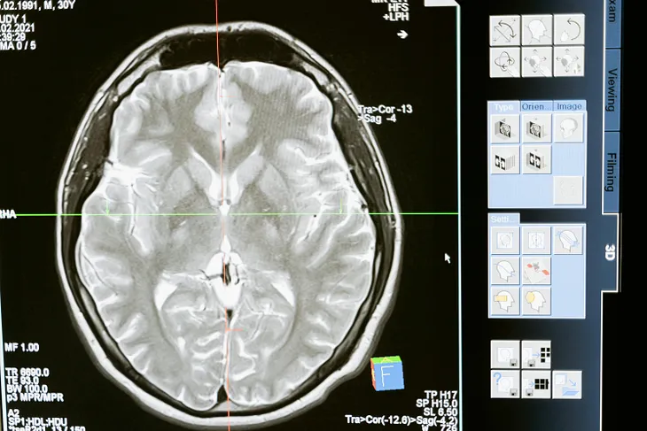 A black and white view of a brain scan.