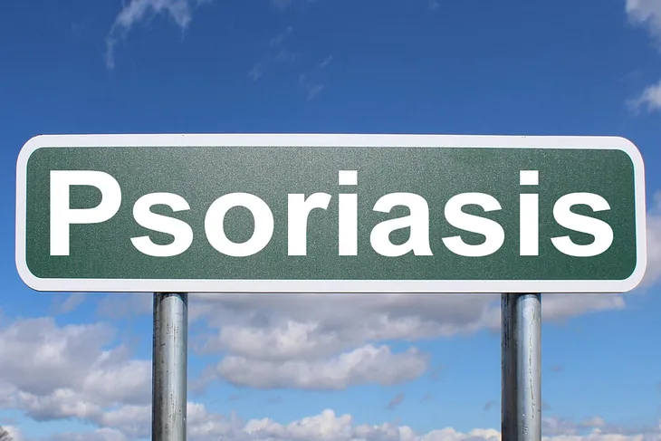 Itolizumab Provides Relief from Psoriasis, Covid-19, and More