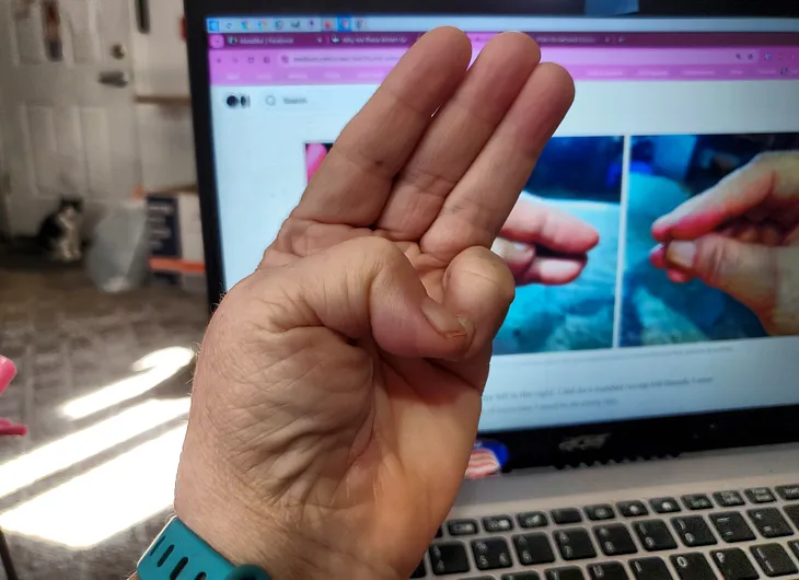 A close-up photo shows a person’s hand making a sign with their thumb and little finger touching. The other three fingers are extended straight up. In the background, there’s a blurred view of a laptop screen displaying what appears to be a webpage.