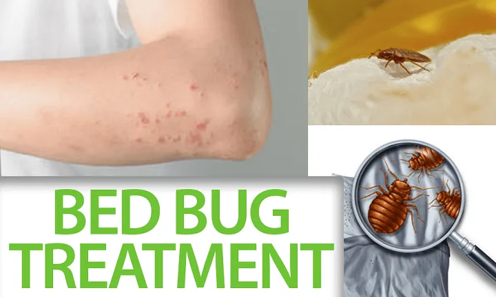 Facts You Need Know About The Bed Bug Treatment