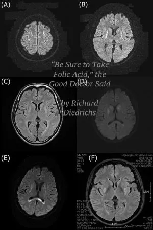 “Be Sure to Take Folic Acid,” the Good Doctor Said