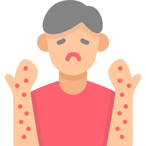 Do You Have A Rash? The Rise in Measles in the UK