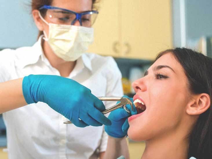 Why Do You Need Tooth Extraction By Emersonbrittan Medium