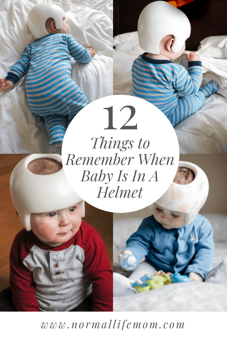 How to Fix Baby’s Flat Head Without Helmet by 1Girl1Boy Medium