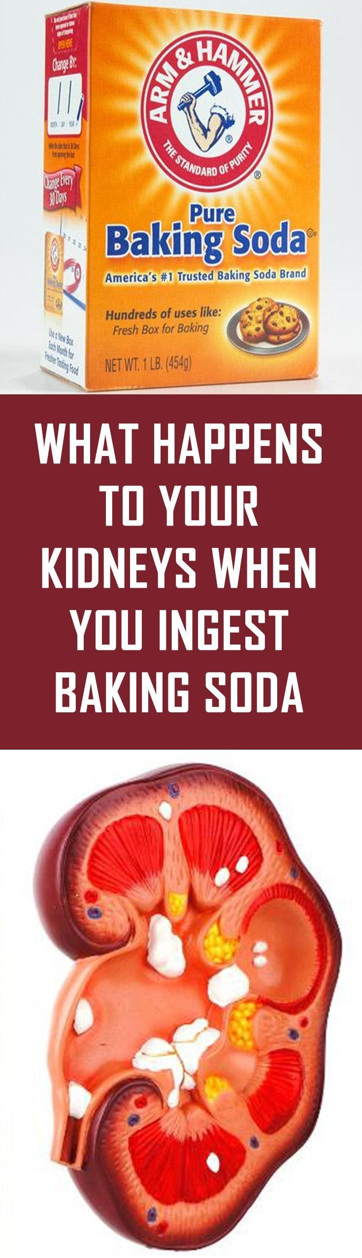 What Happens to Your Kidneys When You Ingest Baking Soda Shirley