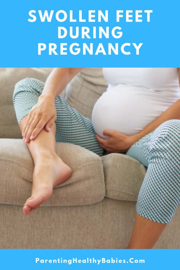 Swollen Feet During Pregnancy: What’s Normal and When Should You Be Concerned?