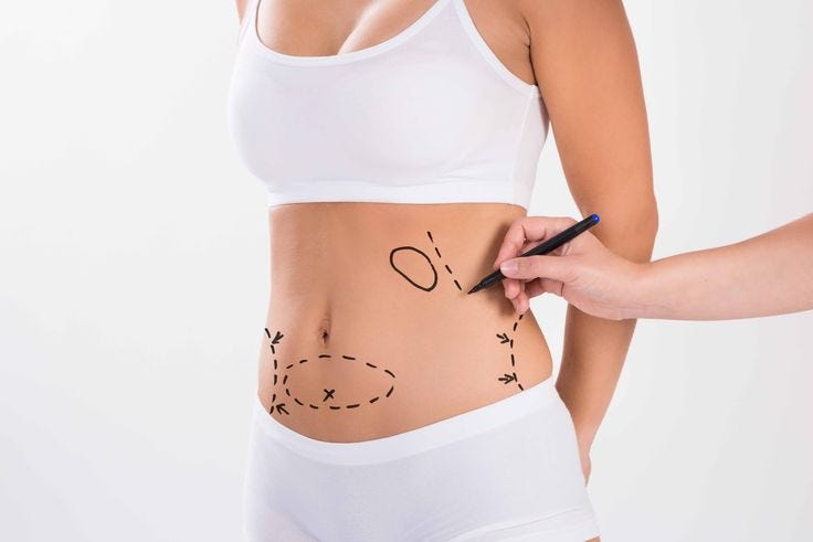 Vaser Liposuction in Islamabad: Benefits and Process
