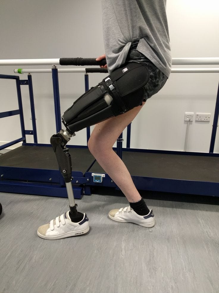 What Factors Affect Prosthetic Leg Below Knee Cost?