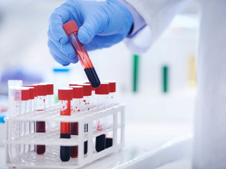 Quick, safe & hassle-free blood sample collection at home 🩸
 RPCS brings professional diagnostic…