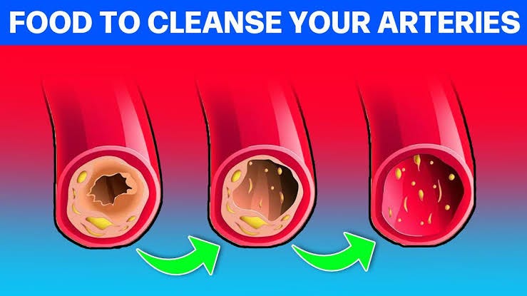 Foods that clean arteries deals