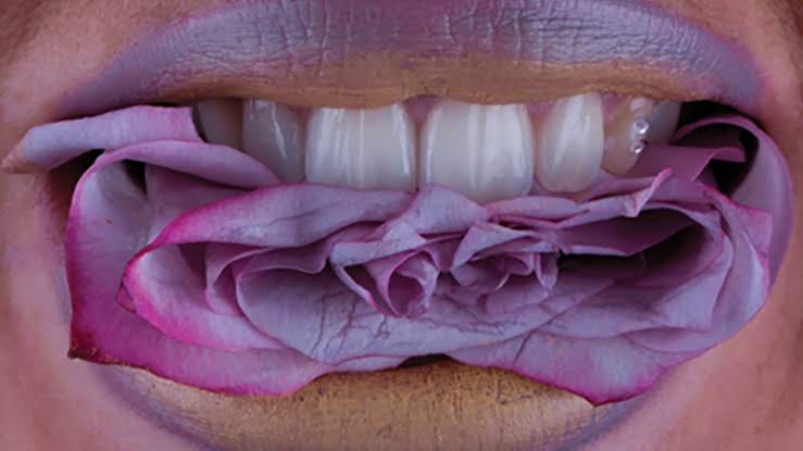 How radiotherapy affects your teeth? a case-report on radiation caries