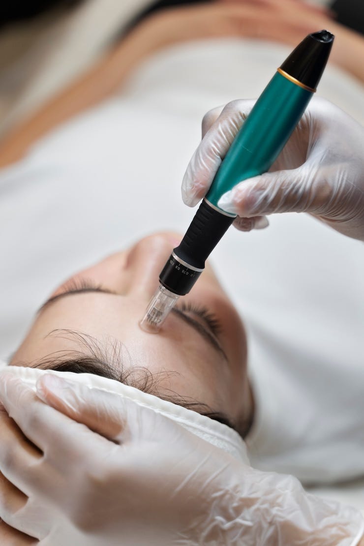 How Effective Is Fractional RF Microneedling ?