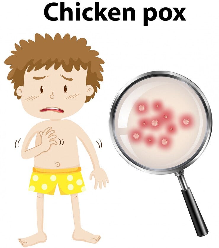What You Need to Know About Antiviral Drugs and Supportive Care for Chickenpox