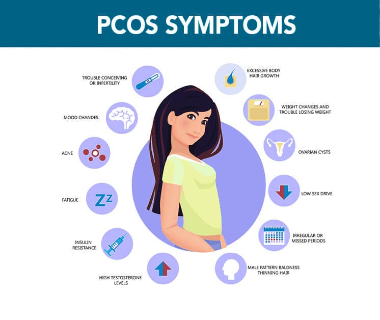 PCOS and Its Common Symptoms. Introduction: Most of the women in… | by ...