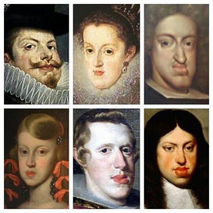 What Was the Habsburg Chin?